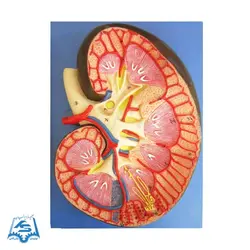 مولاژ کلیه سه قسمتی مدل ASM28