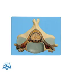 مولاژ نخاع درون مهره مدل ASM38
