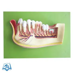 مولاژ دندان نیم فک (دیواری) مدل ASM37