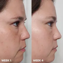 لایه بردار فوری مایع حاوی 2% BHA پائولا چویس حجم 118ml Paulas Choice Skin Perfecting 2% Bha Liquid Exfoliant - فروشگاه اینترنتی قاسمی شاپ