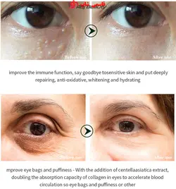 کرم دورچشم کلاژن حلزون ضد چروک ضد پیری - کرم سفید کننده پوست - فروشگاه اینترنتی قاسمی شاپ