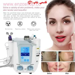 دستگاه هیدروژن و پاکسازی آکواشور جهت زیبای صورت H2 AQUASURE 6IN1 - فروشگاه اینترنتی قاسمی شاپ