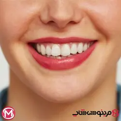 خمیر دندان سفید‌کننده سیگنال White System مدل Guclu Beyazlik حجم 75 میل