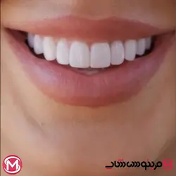 خمیر دندان پرواکسپرت اورال‌بی ۱۲۵میل آلمانی