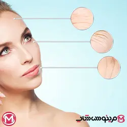 ست لیفت اکتیو ضد‌لک و ضد‌چروک ویشی