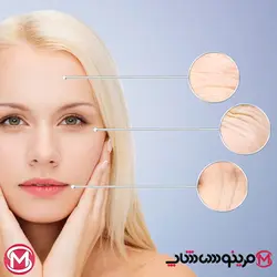 ست لیفت اکتیو ضد‌لک و ضد‌چروک ویشی