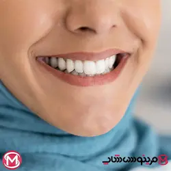 خمیر دندان کرست کومبلیت مدل Herbal fresh حجم 100میل