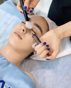 پک اسید تراپی وونوپیل اکلادو