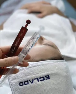 پک اسید تراپی وونوپیل اکلادو