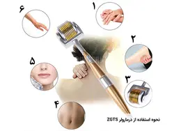 درمارولر زد جی تی اس ZGTS سایز 0.5mm ساخت آلمان با یک سال گارانتی