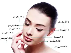 درمارولر زد جی تی اس ZGTS سایز 0.5mm ساخت آلمان با یک سال گارانتی