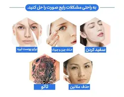 دستگاه پیکوشور (پیکوسکند) مارک انزو ایتالی با یک سال گارانتی ، برای از بین بردن خال کوبی و ملانوم های پوستی محصول 2020