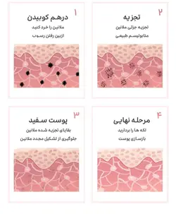 دستگاه پیکوشور (پیکوسکند) مارک انزو ایتالی با یک سال گارانتی ، برای از بین بردن خال کوبی و ملانوم های پوستی محصول 2020