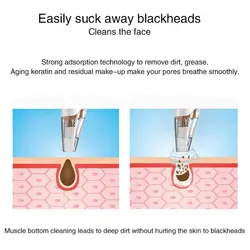 دستگاه میکرودرم بلک هد ابریژن و ابرسان شارژی دیجیتال 75 پاسکال Blackhead Remover Facial Acne Pimple