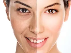 ست پنج عددی مراقبتی و آرایشی هیدراته، هیالورونیک اسید ونزنSet of Skin VENZEN