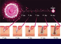 فیلر رشد و تقویت مو هیرفیلر برند DR.CYJ