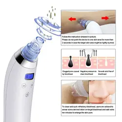 مکش و میکرودرم کومودو ساکشن Comodo Suction