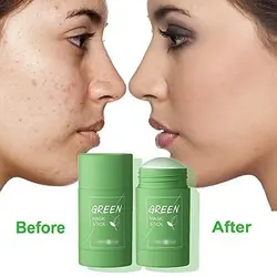 ‎استیک ماسک جادویی لایه بردار و تمیز کننده عمیق پوست GREEN MASK
