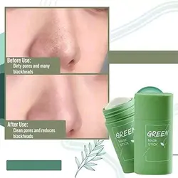 ‎استیک ماسک جادویی لایه بردار و تمیز کننده عمیق پوست GREEN MASK