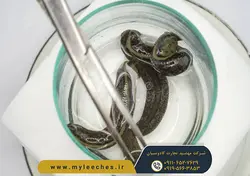 خرید انلاین پک 20 عددی زالو طبی