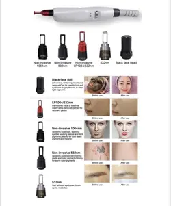 ستگاه لیزر حذف تاتو پیکوثانیه انزو ایتالیا - ستار سنتر