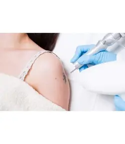 لیزر حرفه ای کیوسوییچ حذف خال زگیل و تاتو (تتو) 3000 میلی ژول طرح جدید مدل 2020 برند سایان با یک سال گارانتی Q-SWITCHED