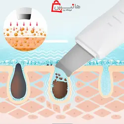 اتو صورت درما اف سه کاره اولتراسونیک Ultrasonic beauty start
