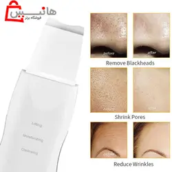 اتو صورت درما اف سه کاره اولتراسونیک Ultrasonic beauty start
