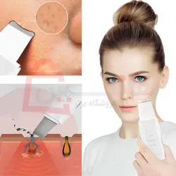 اتو صورت درما اف سه کاره اولتراسونیک Ultrasonic beauty start