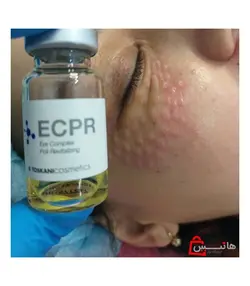 کوکتل دور چشم میکرونیدلینگ ECPR برند توسکانی