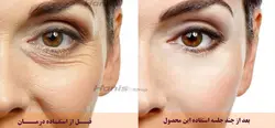 کوکتل دور چشم میکرونیدلینگ ECPR برند توسکانی