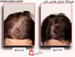 هیر فیلر پرو مو مزولایک اسپانیا Mesolike Hair Filler Pro