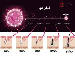 هیر فیلر مو کره ای Hair Filler Dr.Cyj