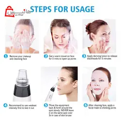 میکرودرم بلک هد 5 قدرته چراغ دار BLACKHEAD REMOVER