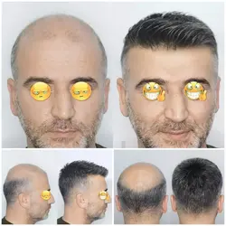 پروتز مو طبیعی هشت تیکه VIP درصدار (خانی) - فروشگاه چسب و پروتز موی خانی