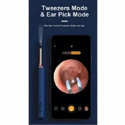 گوش پاک کن شیائومی Bebird Note3 Pro 3-in-1 Multifunctional Earwax Removal