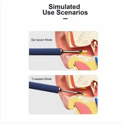 گوش پاک کن شیائومی Bebird Note3 Pro 3-in-1 Multifunctional Earwax Removal