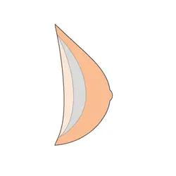 پروتز سینه اکسترنال فوق سبک آموئنا آلمان مدل Natura Xtra Light 2SN