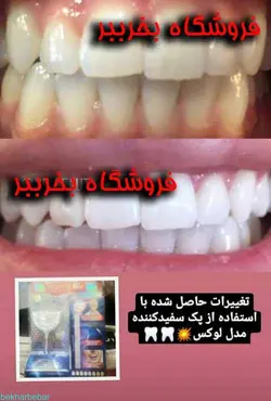 خرید بلیچینگ دندان در منزل بلیچ حرفه ای سفید کننده دندان 2023