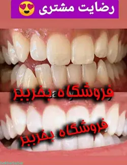 خرید بلیچینگ دندان در منزل بلیچ حرفه ای سفید کننده دندان 2023