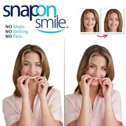 لمینت متحرک دندان snap on smile