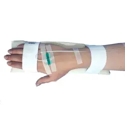 آتل رگ گیری - PDTmedical