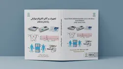 تجهیزات و آنالیز الکتروکاردیوگرافی (ECG یا EKG)