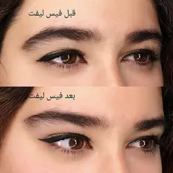 کش لیفت چشم و ابرو