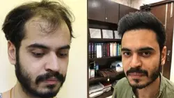 قرص نورکرین آقایان