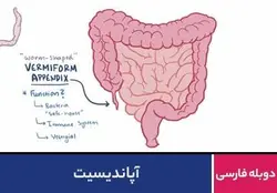 آپاندیسیت
