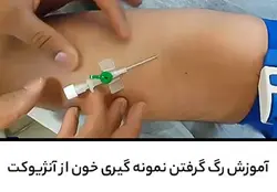 آموزش رگ گرفتن نمونه گیری خون از آنژیوکت