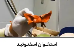 استخوان اسفنوئید