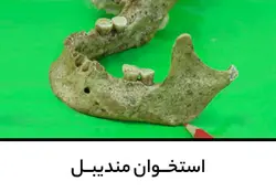 استخوان مندیبل
