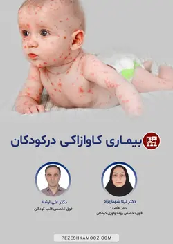 بیماری کاوازاکی در کودکان